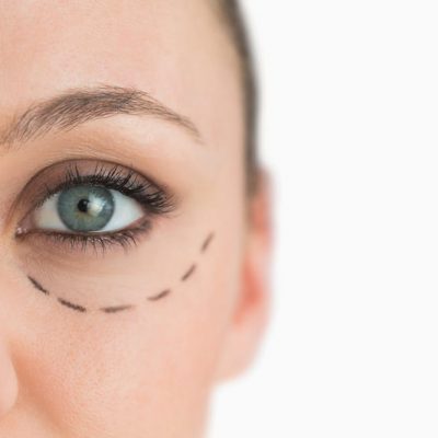 10 Things To Consider Before Getting Cosmetic Surgery