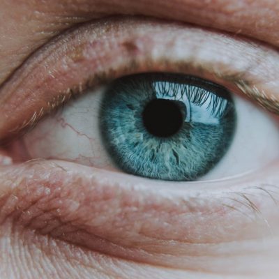 What causes pink eye?